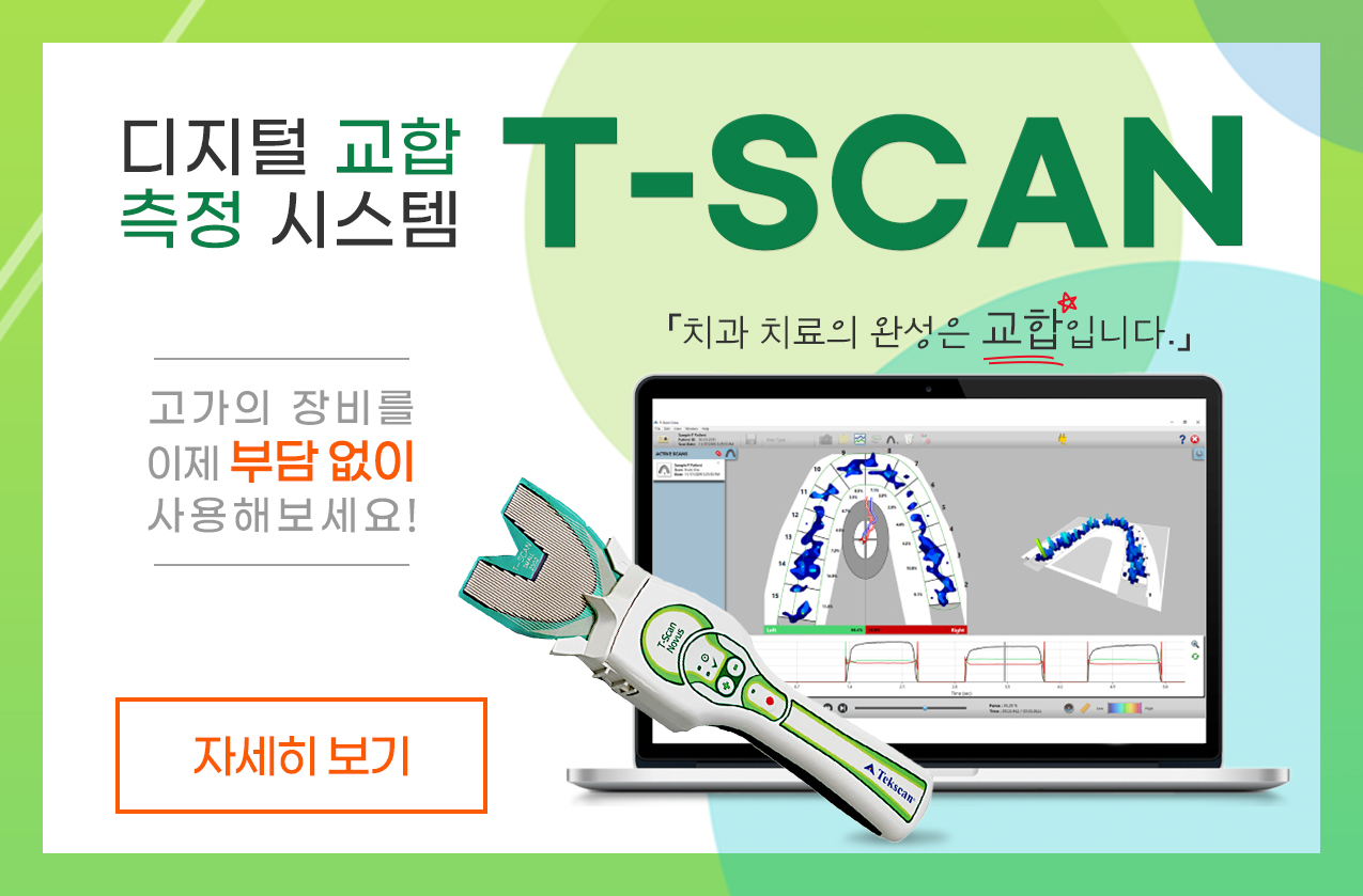 tscan