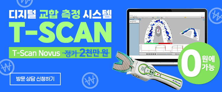tscan